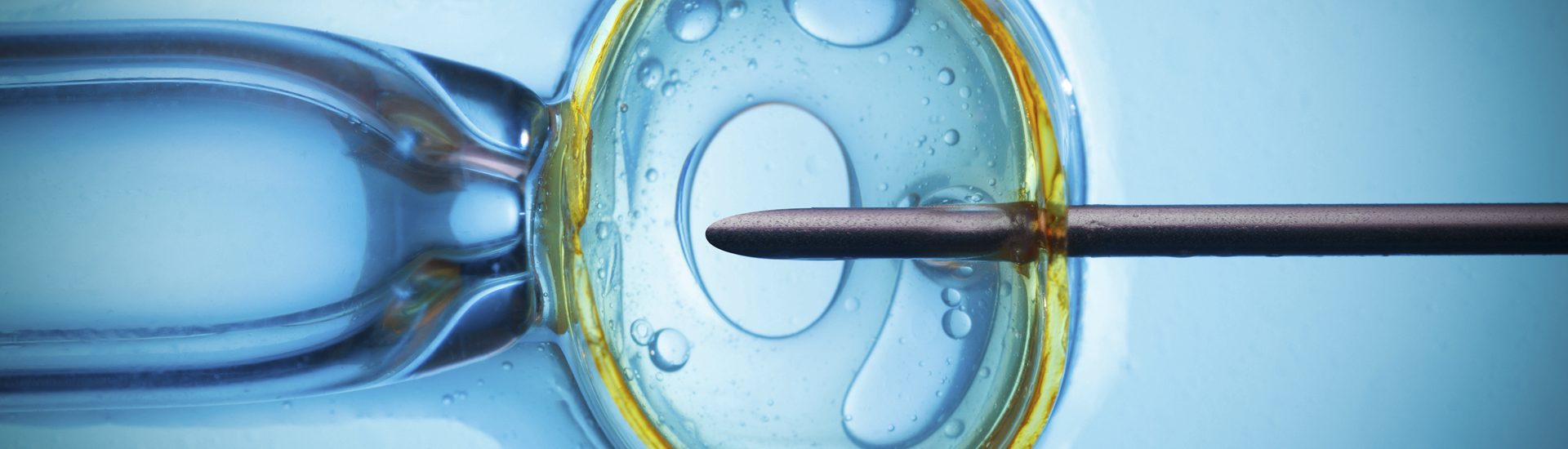 林時羽 胚胎植入前的遺傳篩檢